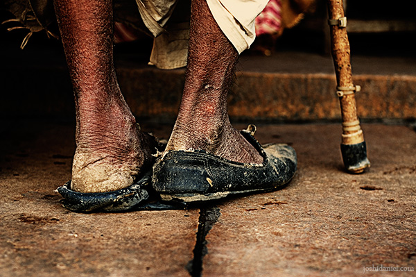 Man from Jaisalmer wearing worn out shoes